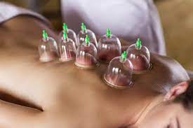 cupping therapy for relaxation and pain relief at San Fulgencio, Spain.”